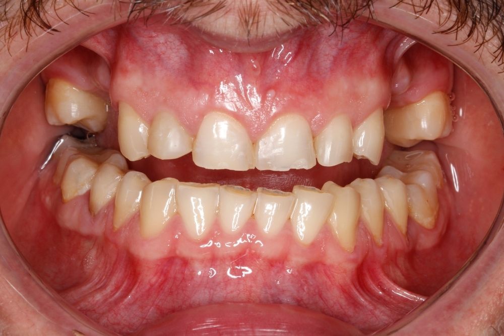 Before image